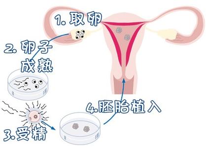 高齡二胎